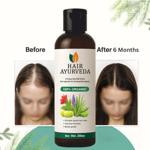 Hair Ayurveda – Strong Ayurvedic Hair Re-growth Oil, Premium Quality