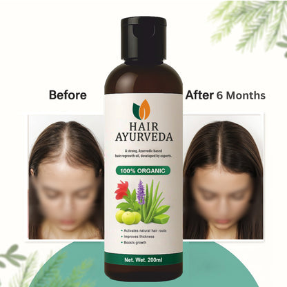 Hair Ayurveda – Strong Ayurvedic Hair Re-growth Oil, Premium Quality