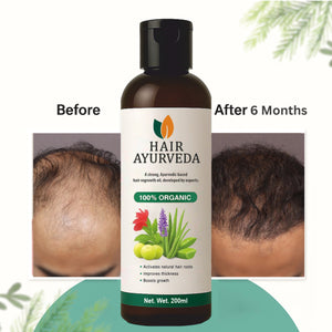 Hair Ayurveda – Strong Ayurvedic Hair Re-growth Oil, Premium Quality