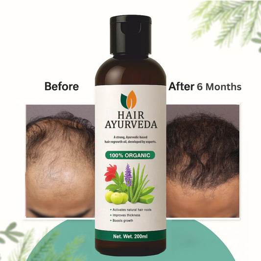 Hair Ayurveda – Strong Ayurvedic Hair Re-growth Oil, Premium Quality